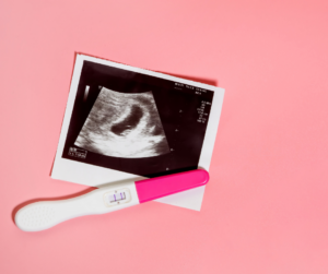 난임부부 시술비 지원사업 신청